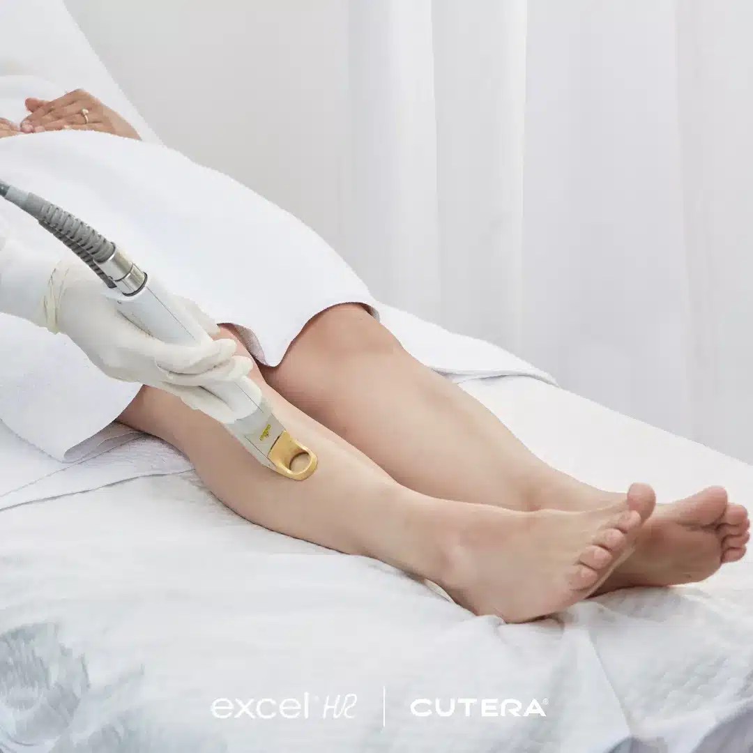 Laser Hair Removal Calgary The Cost of Full Body Hair Removal