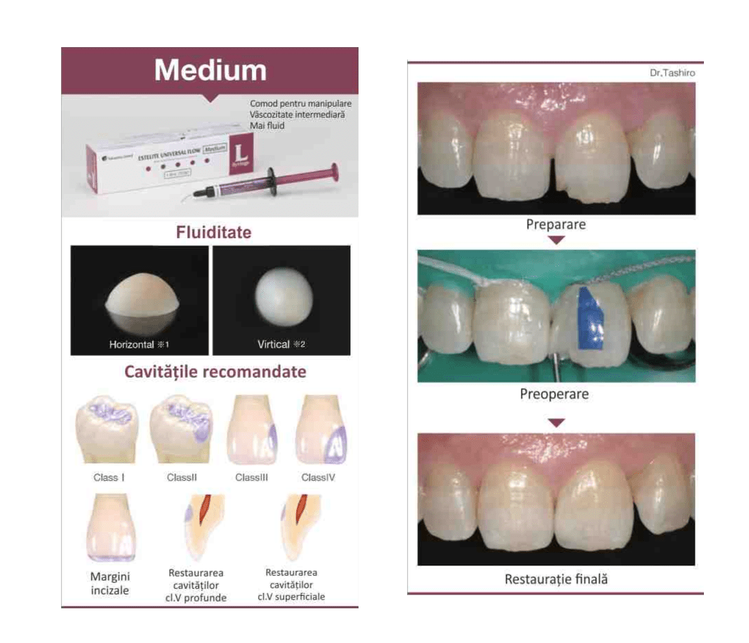 ESTELITE UNIVERSAL FLOW MEDIUM 3G Vivimed