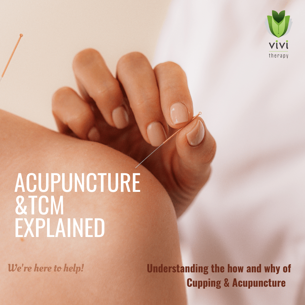 Acupuncture Explained Vivi Therapy