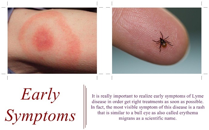 Symptoms of lyme disease in humans Newstrendline.Com