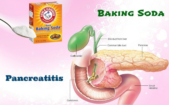 17 Home Remedies For Pancreatitis Pain And Symptoms