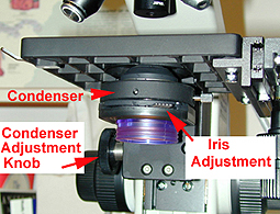 Condenser Adjustment Knob