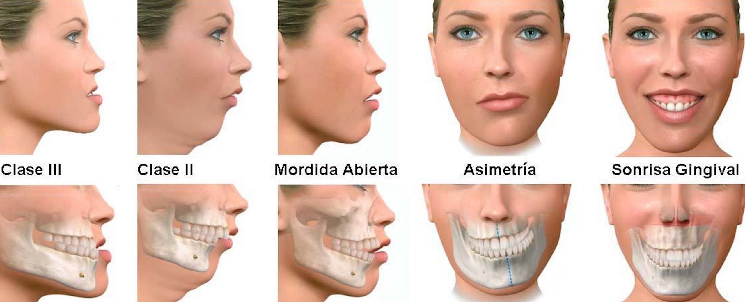 Cirugía ortognática, equilibrio y mordida perfecta para la cara más