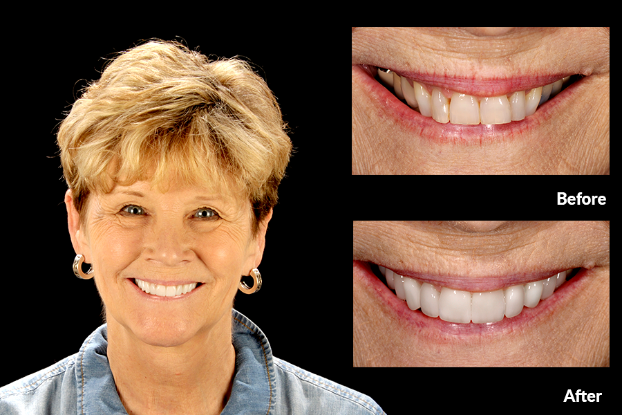 Best Cosmetic Dentist In The World