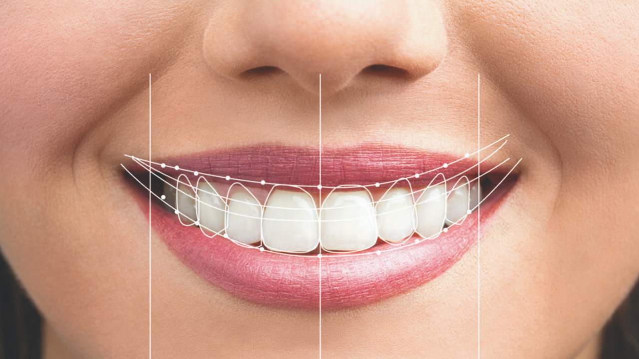 Smile Design Vũ Gia Lab