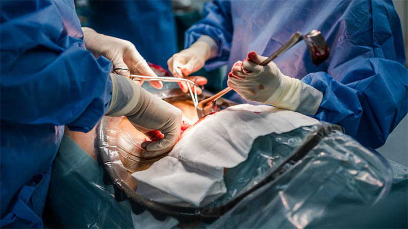 Maria's Story Elective csection Wait for White