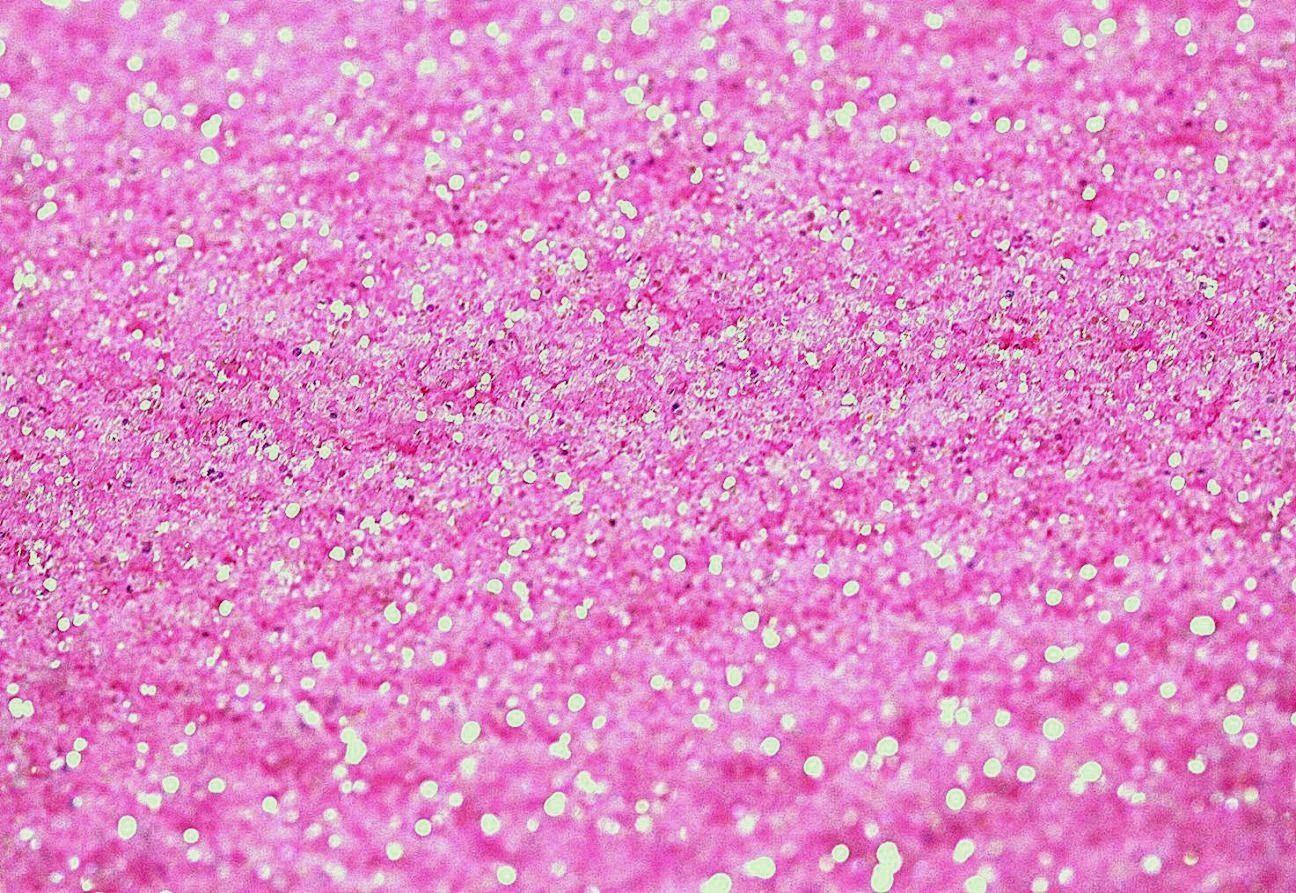 Pink Glitter Wallpapers Top Free Pink Glitter Backgrounds