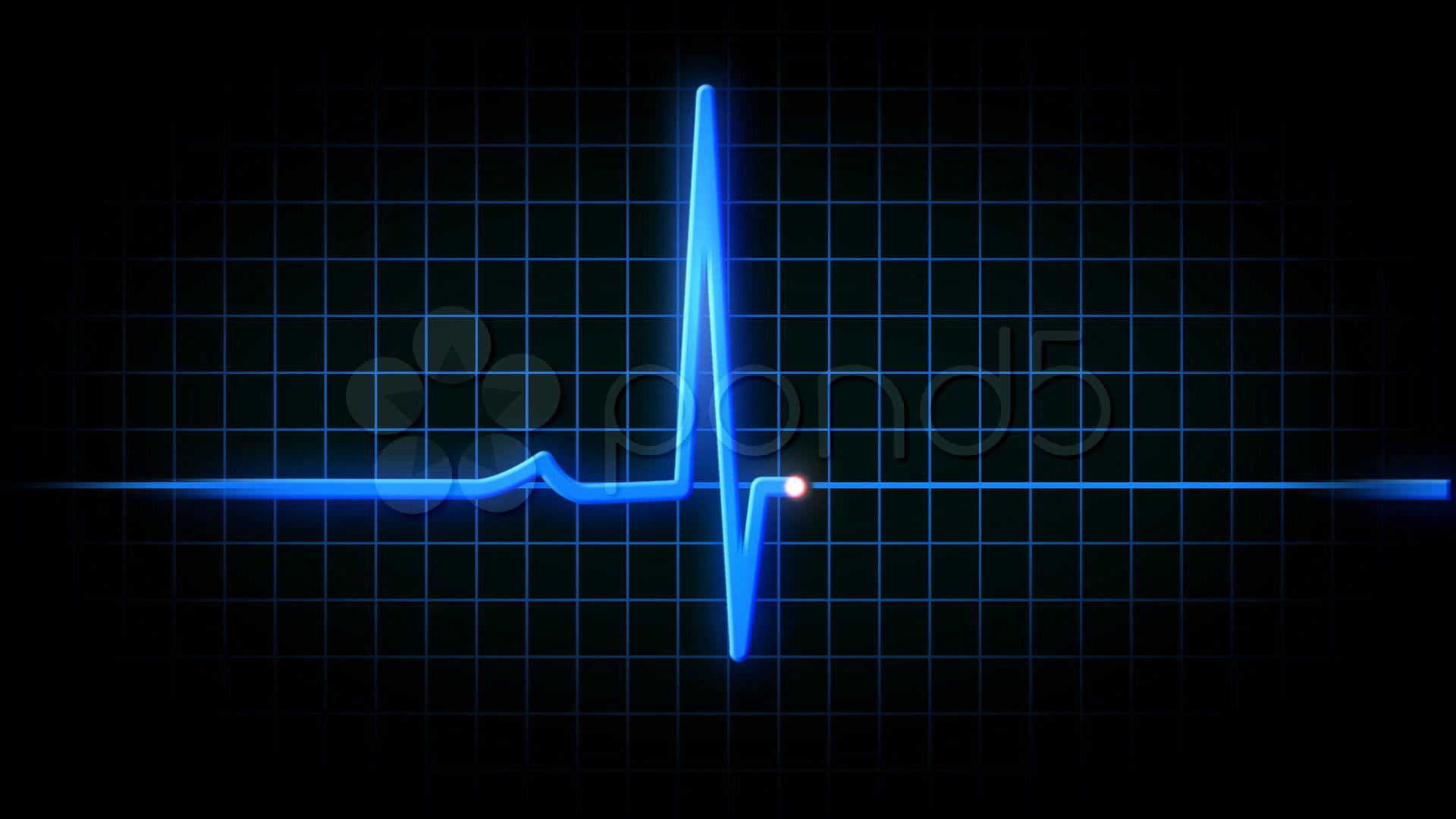 Heart Monitor Flatline Wallpapers Top Free Heart Monitor Flatline