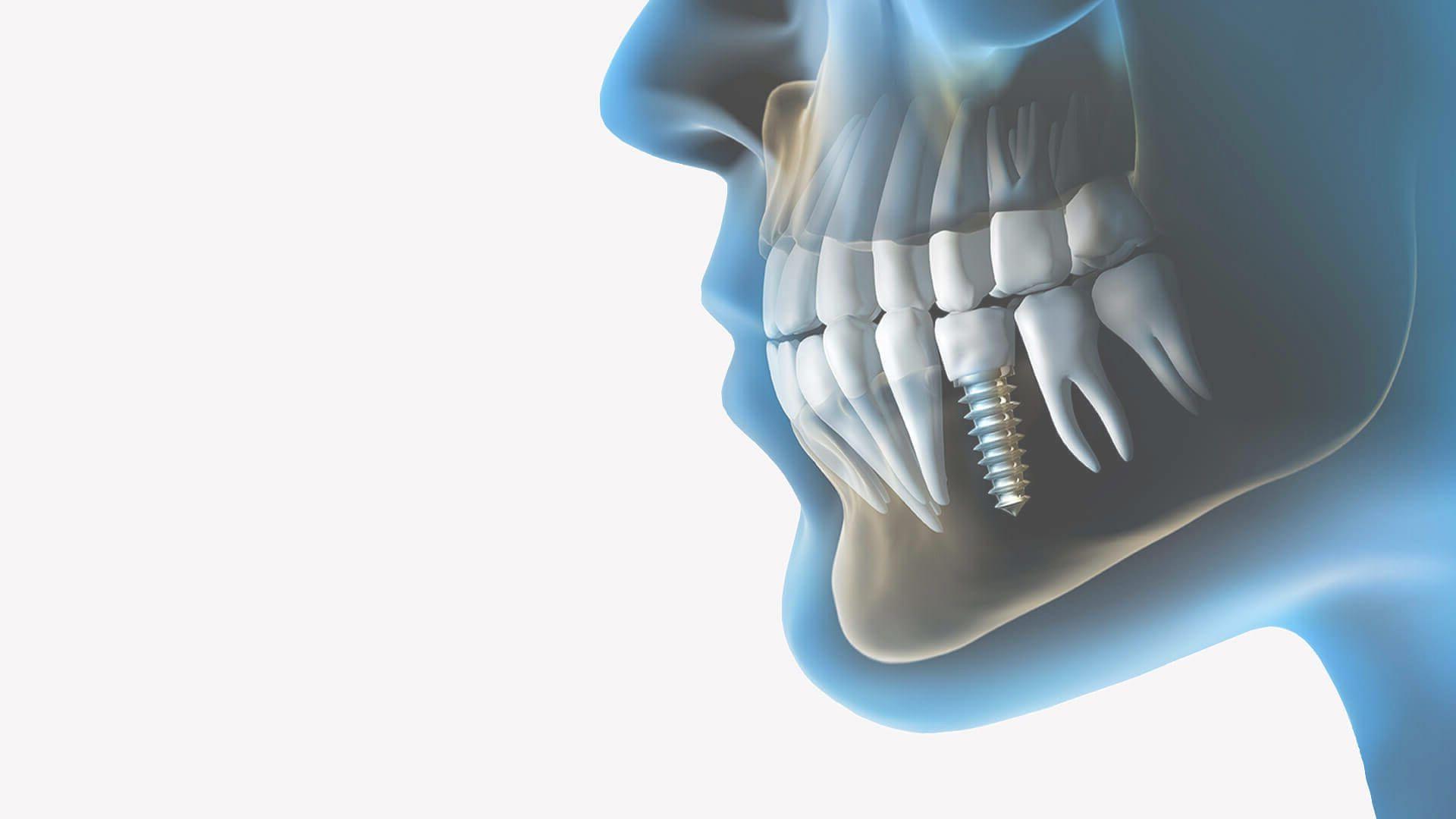 Dentistry Wallpapers Top Free Dentistry Backgrounds WallpaperAccess