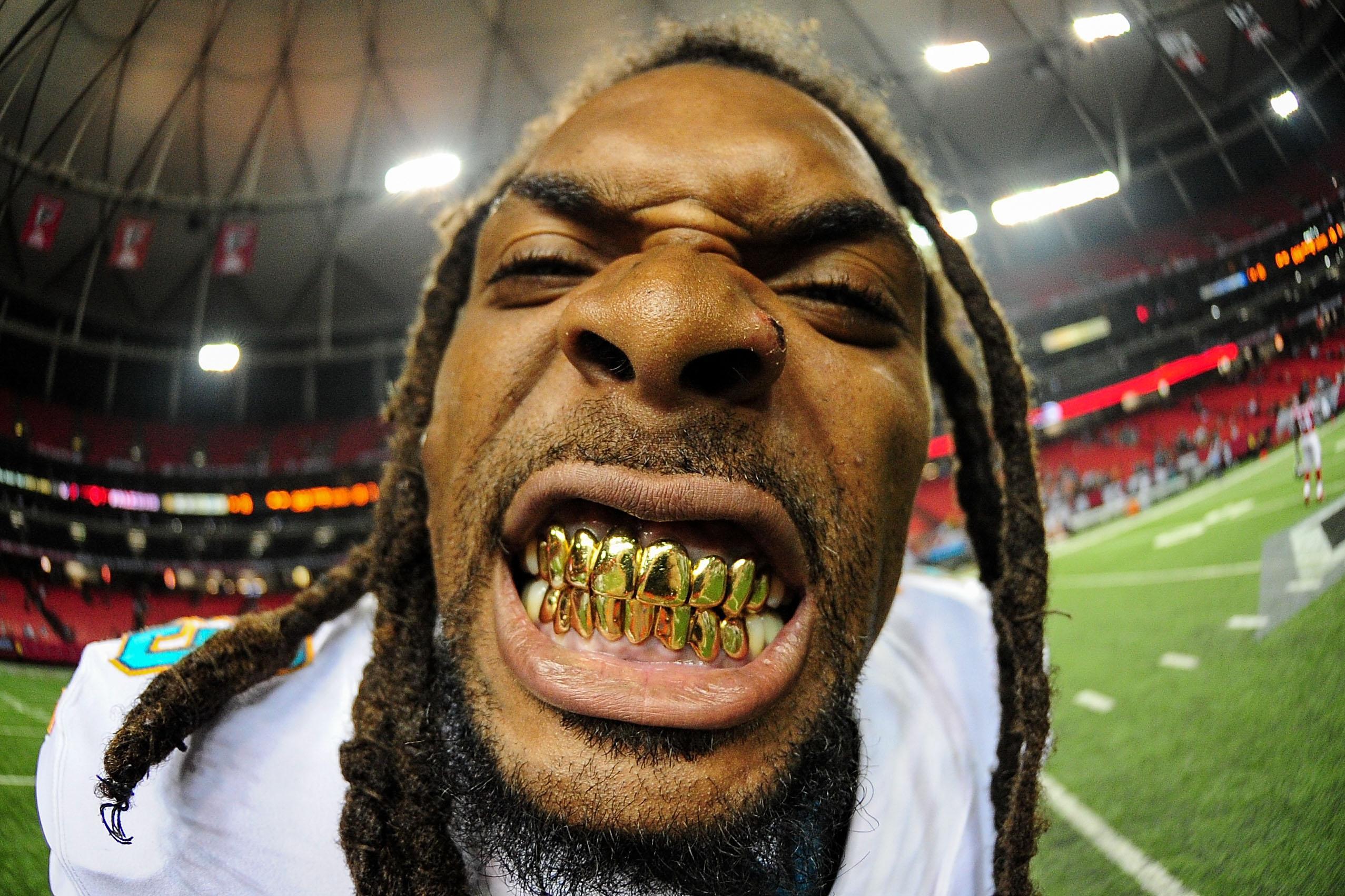 Grillz Wallpapers Top Free Grillz Backgrounds WallpaperAccess