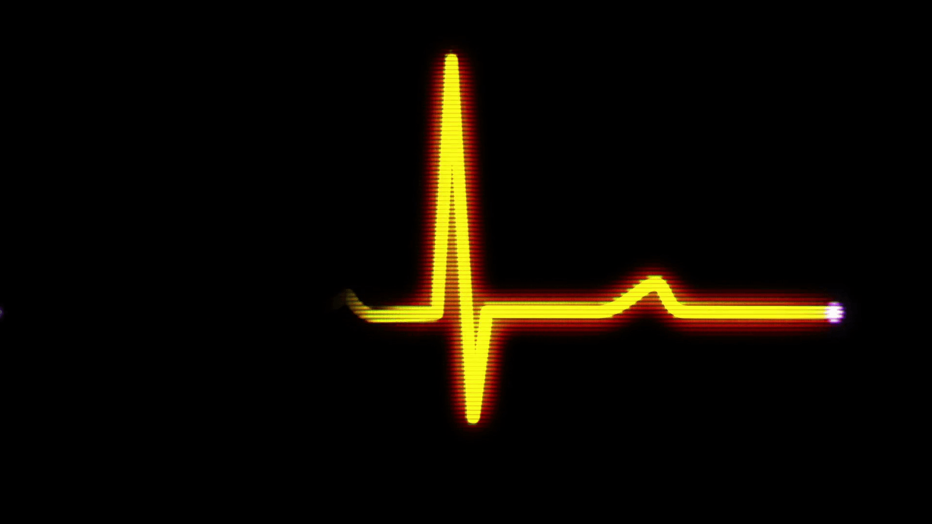 Heart Monitor Flatline Wallpapers Top Free Heart Monitor Flatline