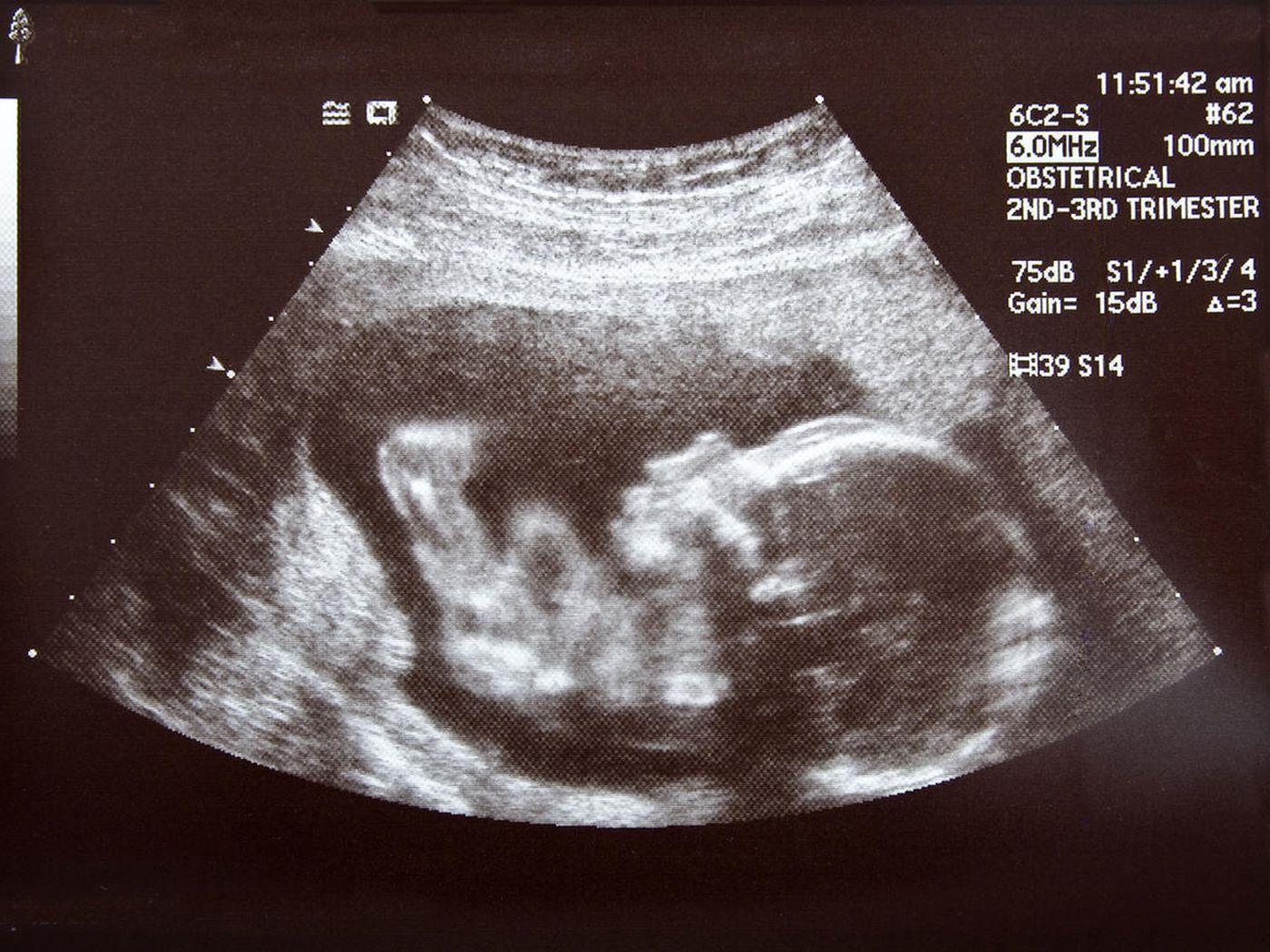 Ultrasound Wallpapers Top Free Ultrasound Backgrounds WallpaperAccess