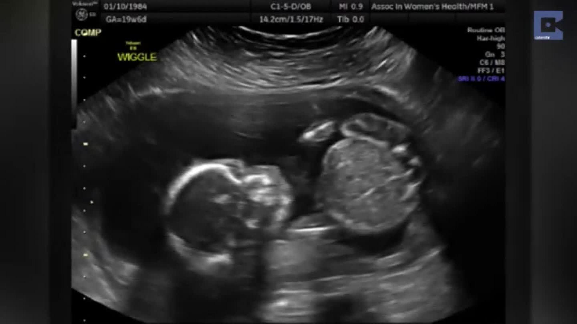 Ultrasound Wallpapers Top Free Ultrasound Backgrounds WallpaperAccess