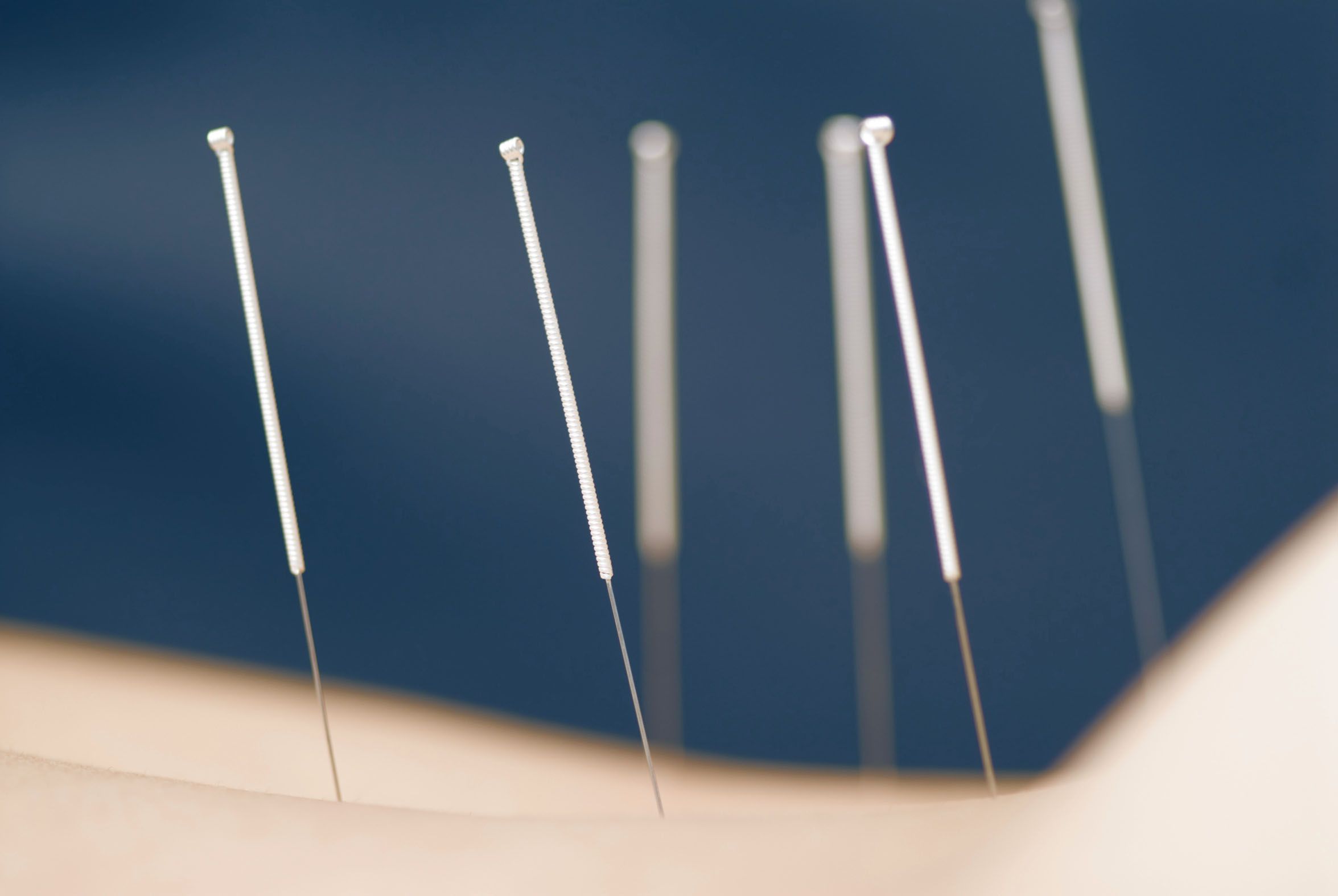 Acupuncture Wallpapers Top Free Acupuncture Backgrounds WallpaperAccess