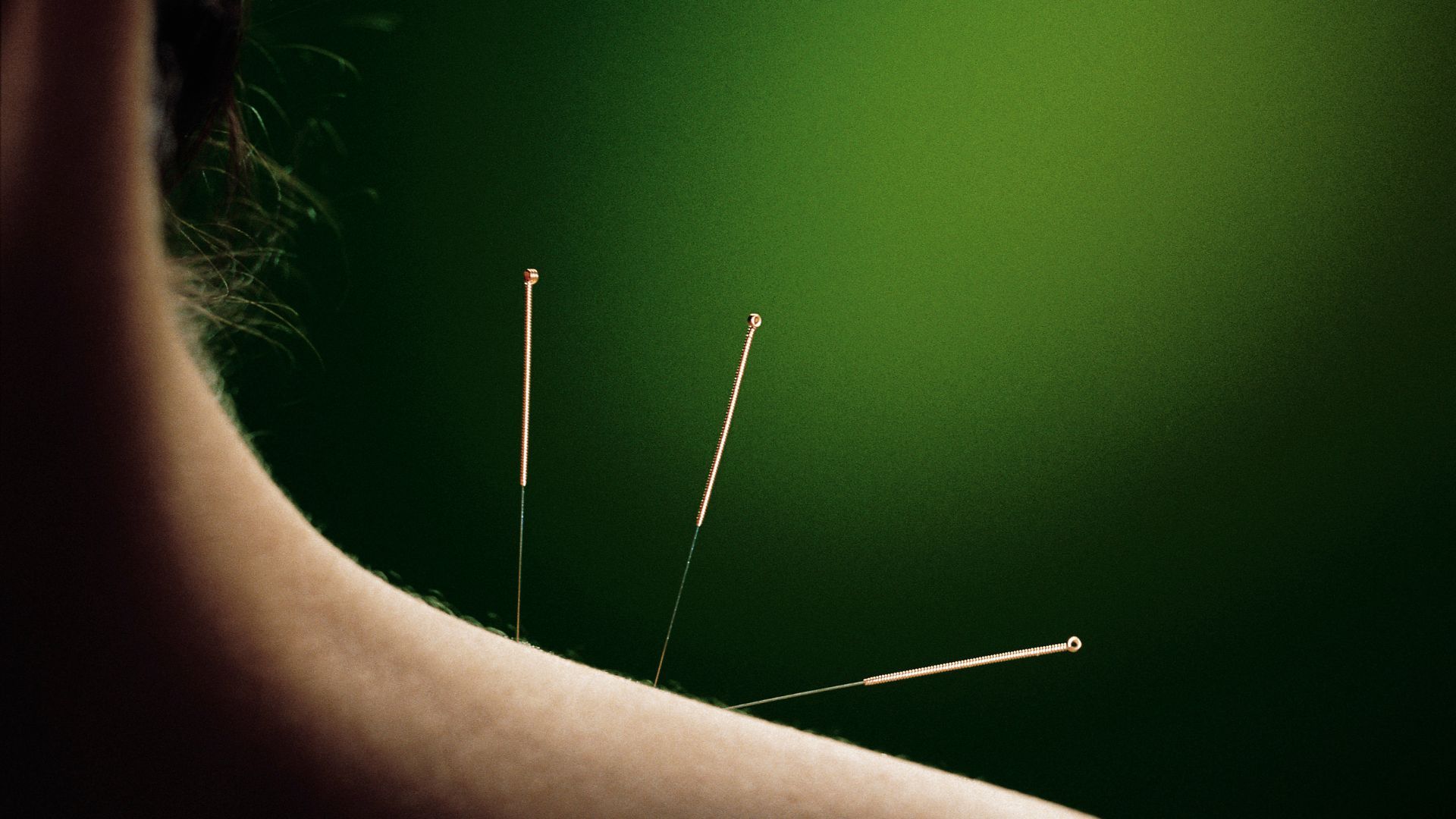 Acupuncture Wallpapers Top Free Acupuncture Backgrounds WallpaperAccess