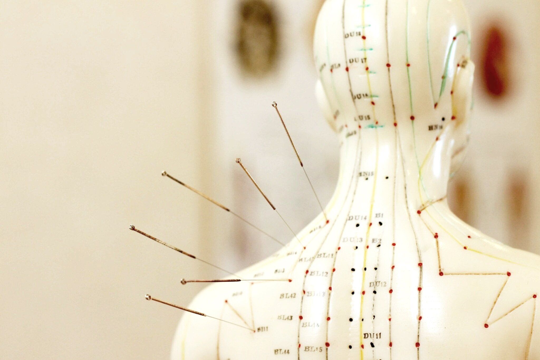 Acupuncture Wallpapers Top Free Acupuncture Backgrounds WallpaperAccess