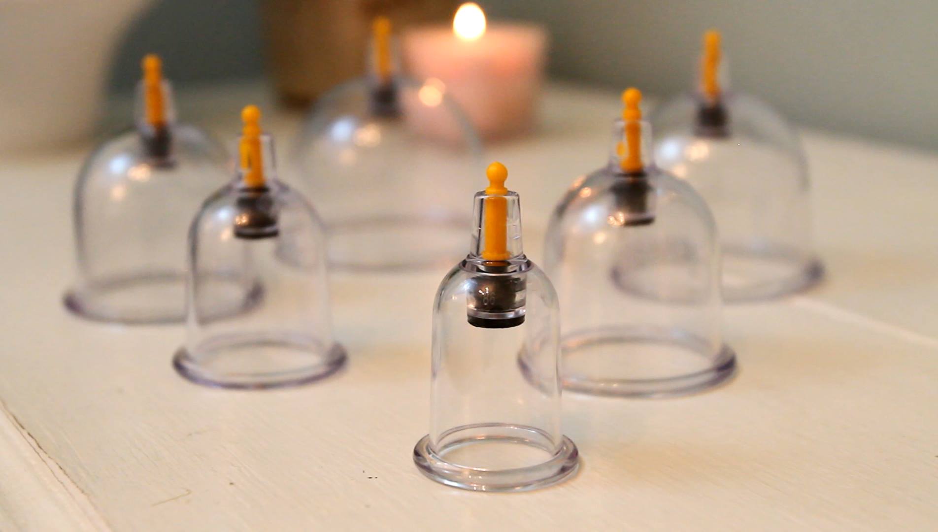 Eating Disorders Alternative Therapies THE CUPPING THERAPY Islam and