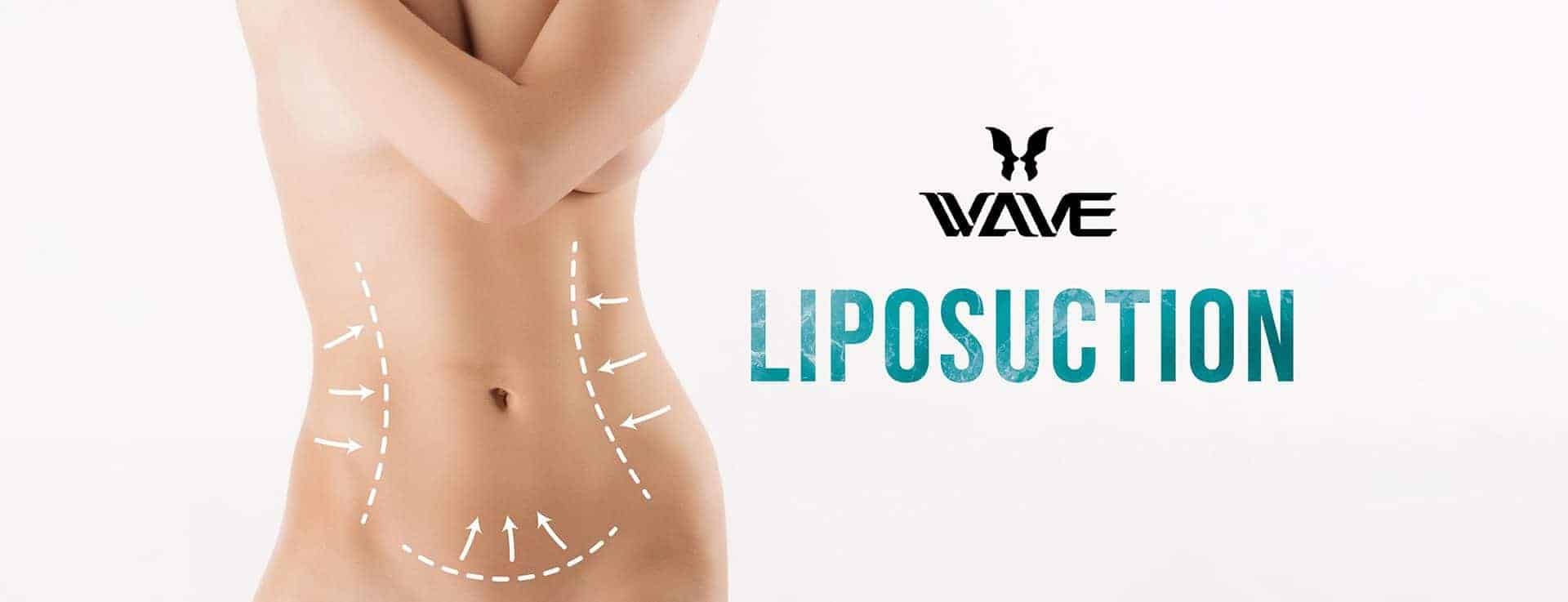 Liposuction Cost Wave Plastic Surgery