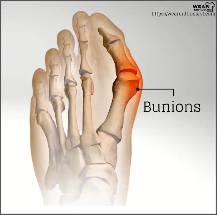 Why Do Vionic Shoes Hurt My Feet? Guide)