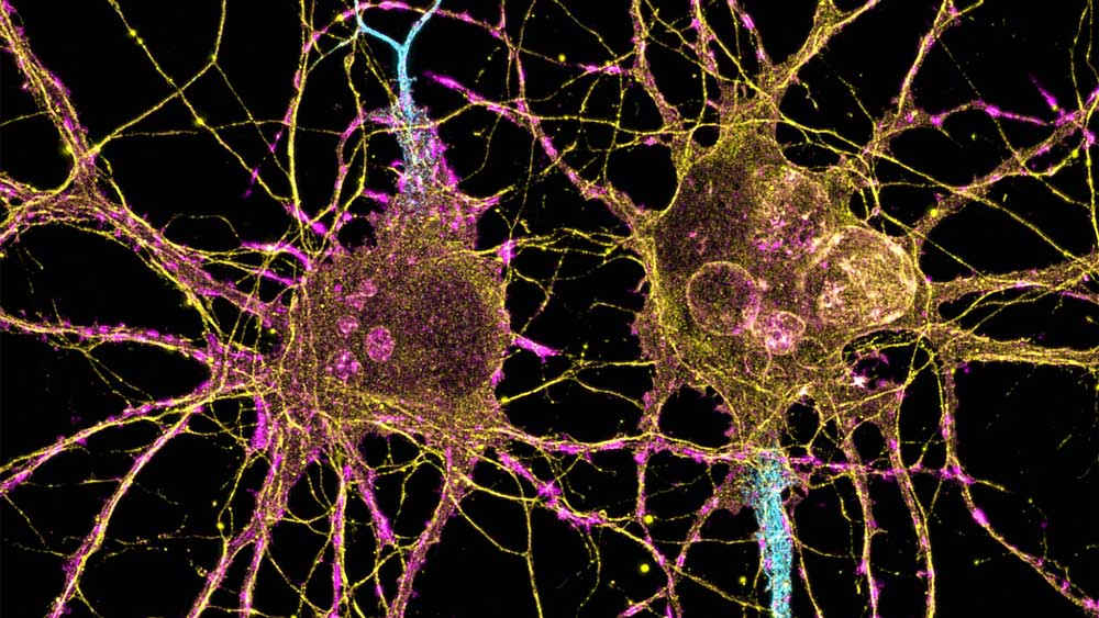 Spotlight Huntington’s and neurons MIT Massachusetts Institute of