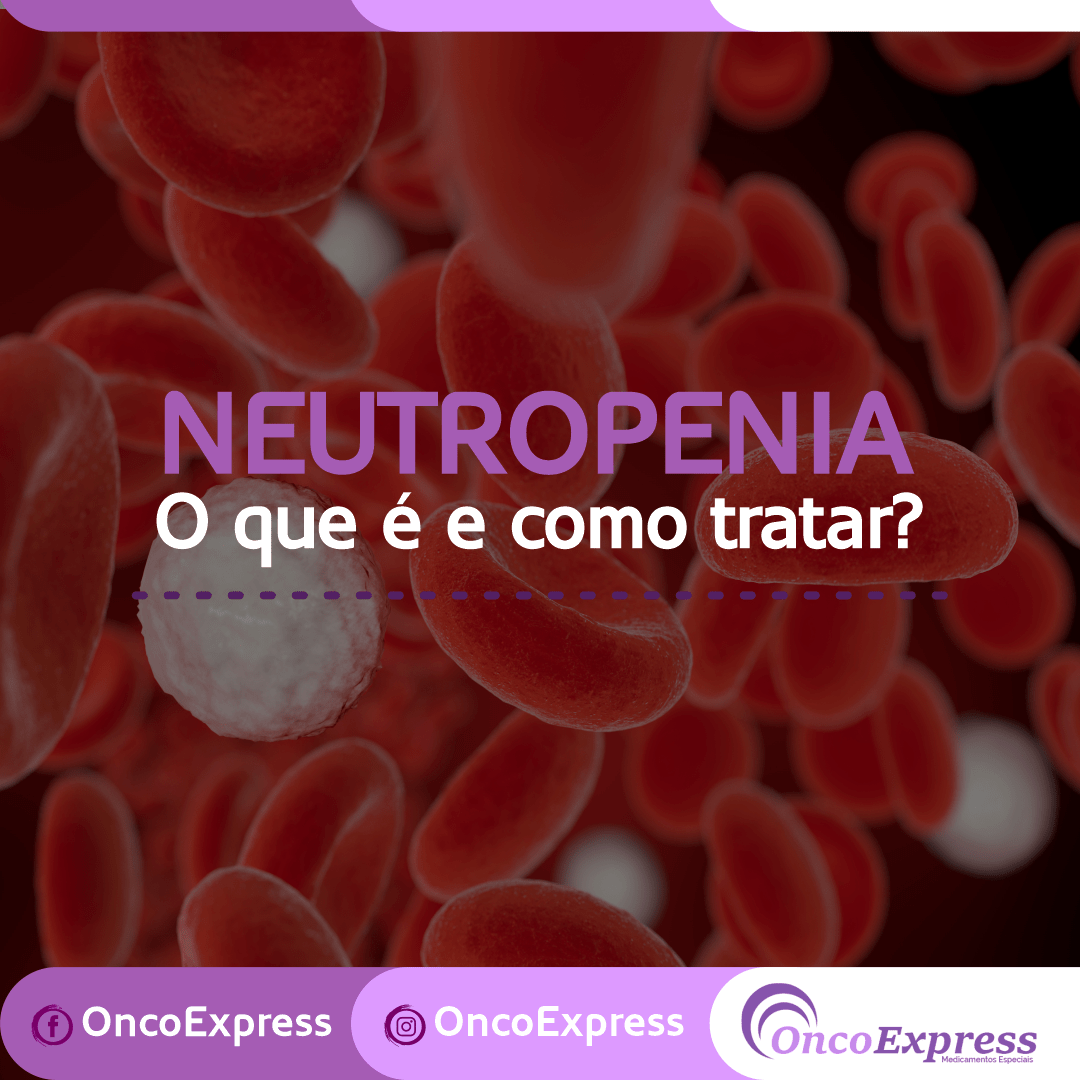 Neutropenia, o que é e como tratar OncoExpress