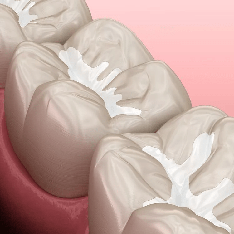 Root Canal Alternatives Everything You Need to Know  DMD