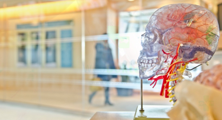 Stroke: Gejala, Penyebab, dan Cara Menanganinya -
