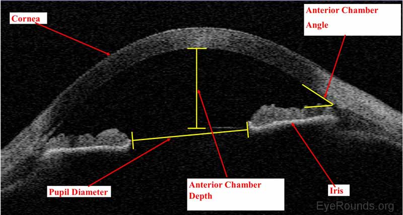 Corneal Imaging An Introduction