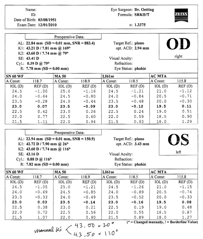 Phacoemulsification Considerations for Astigmatism Management