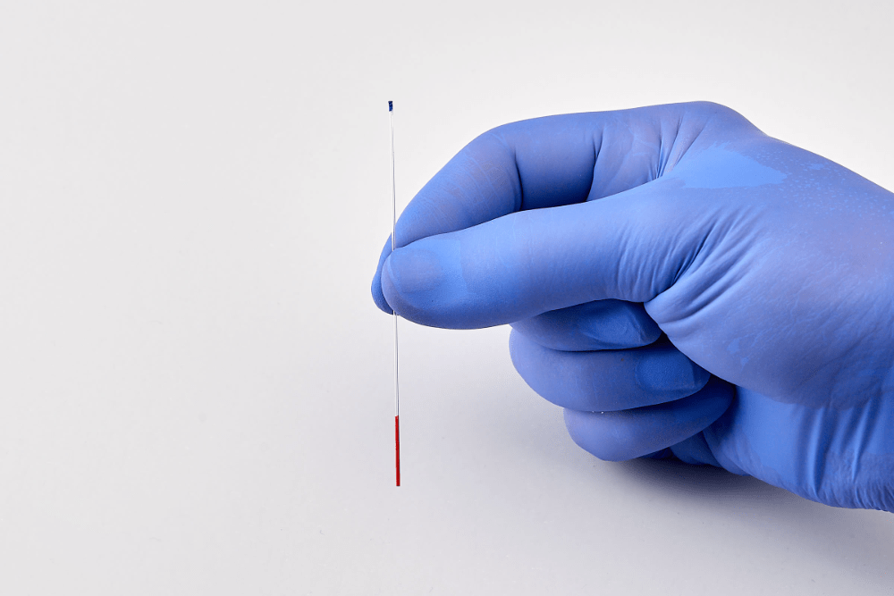 Spermatozoa Vitrification AG Reproduktionsmedizin
