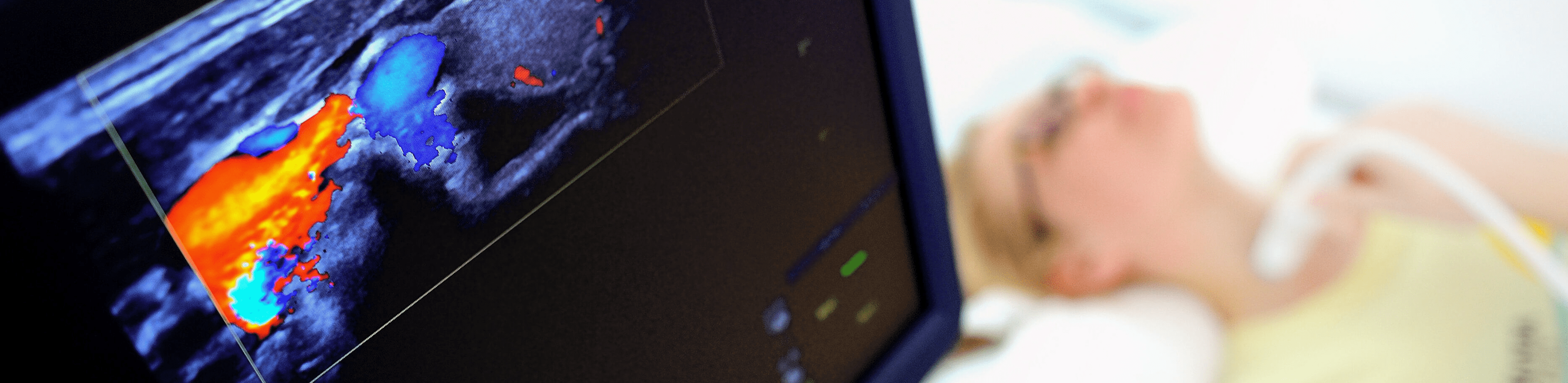 PSMA PETCTDiagnostik Prostatakrebs Erkrankungen & Therapien Nuklearmedizin Uniklinik Köln