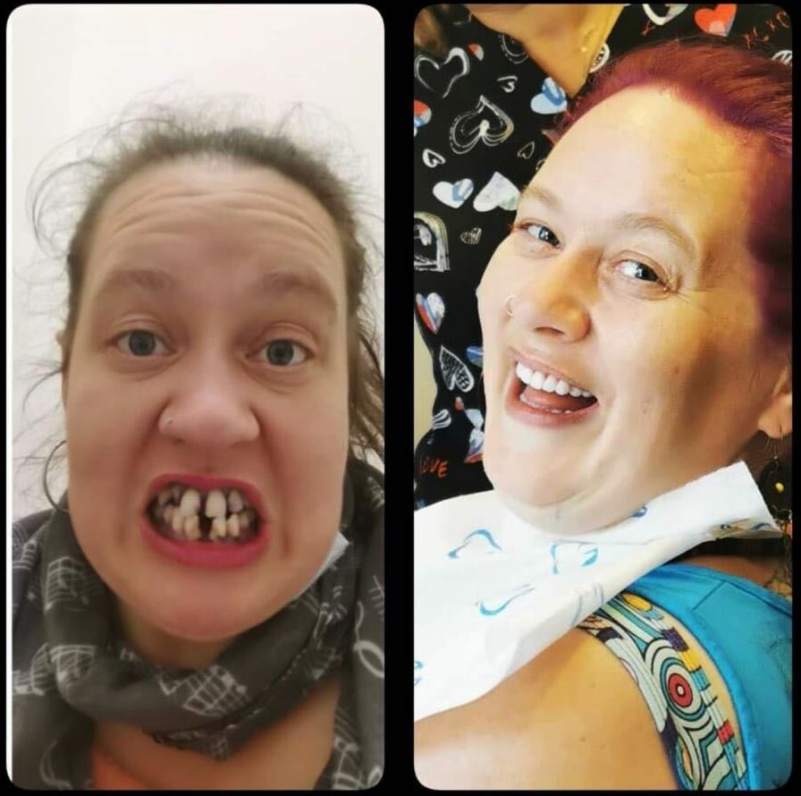 Dental Treatment in Turkey without getting Turkey Teeth!