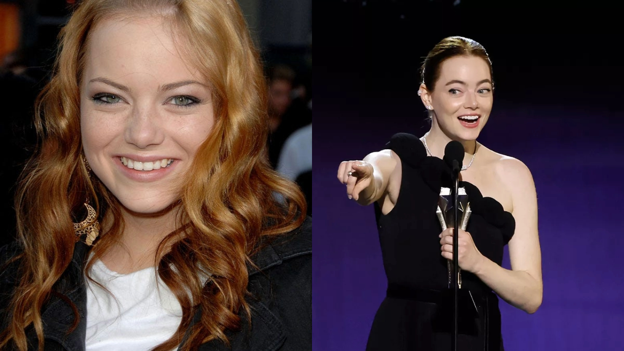 Does Emma Stone Have a Surgical Nose or Has It Evolved Naturally?