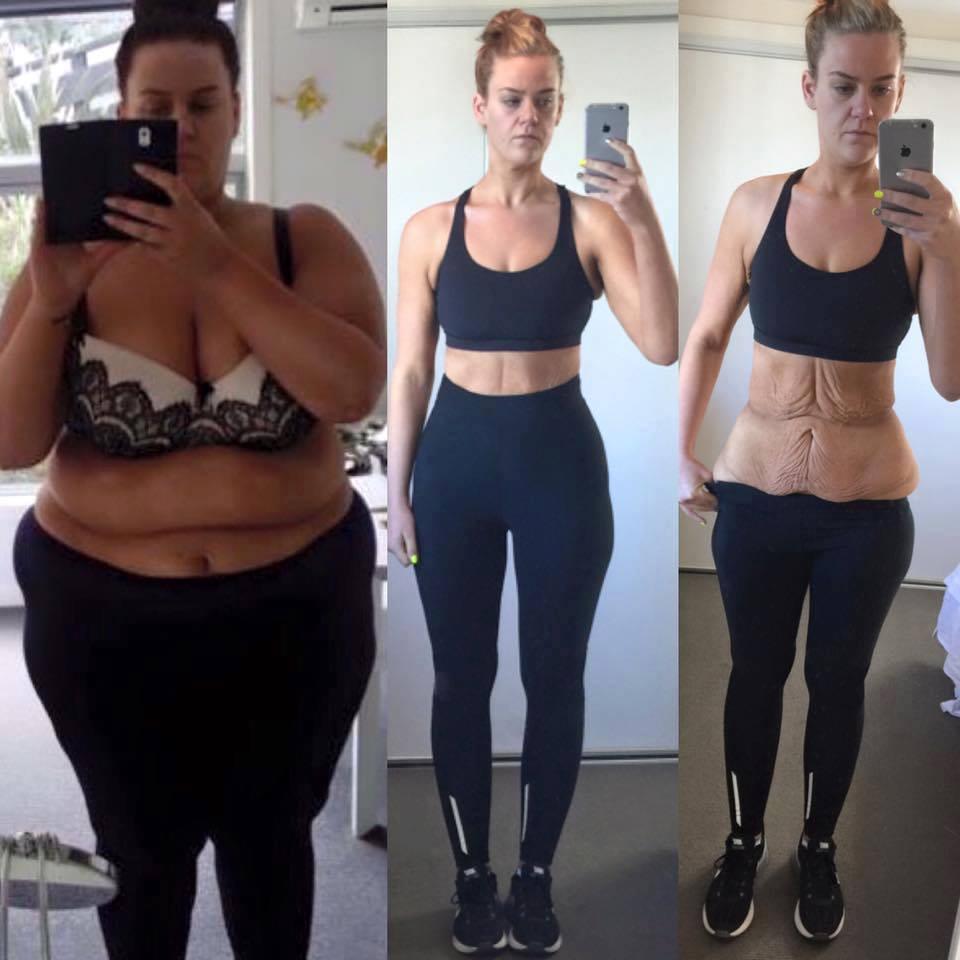 before and after weight loss photos