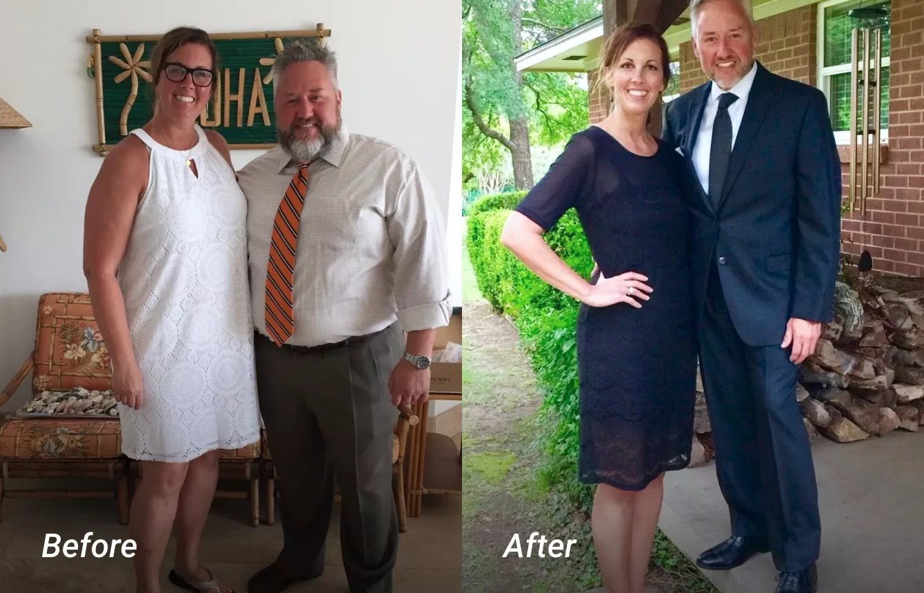 Home Weight Loss Surgeon