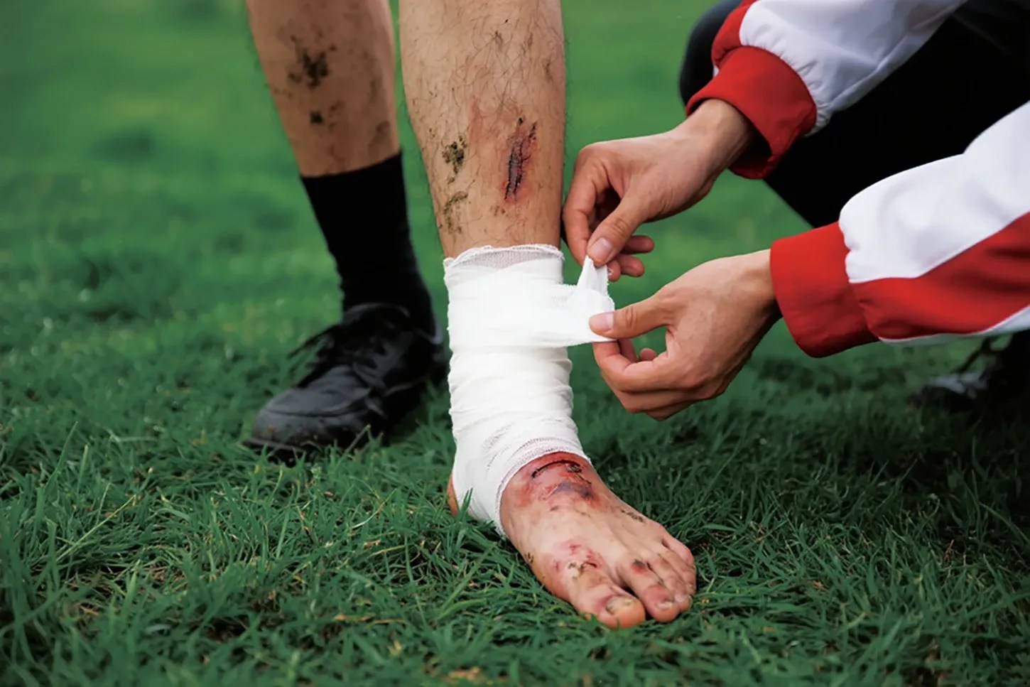 Sports‑Related Wounds Weimei Biotech