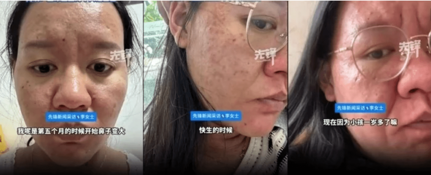The Shocking Physical Transformation That Made a Pregnant Woman
