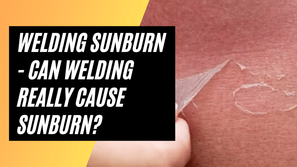 Welding Sunburn Can Welding Really cause sunburn? Effect on Skin and Eyes