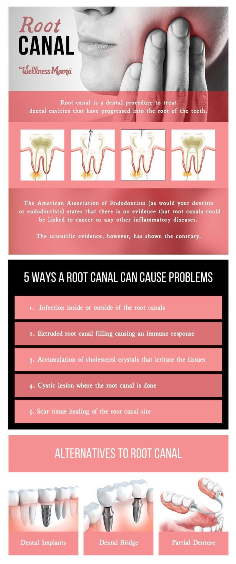 Are There Hidden Dangers to Getting a Root Canal? Wellness Mama