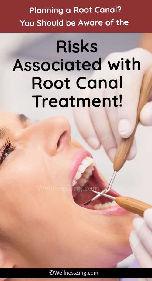 Root Canal Pro's and Cons and How to Prevent it?