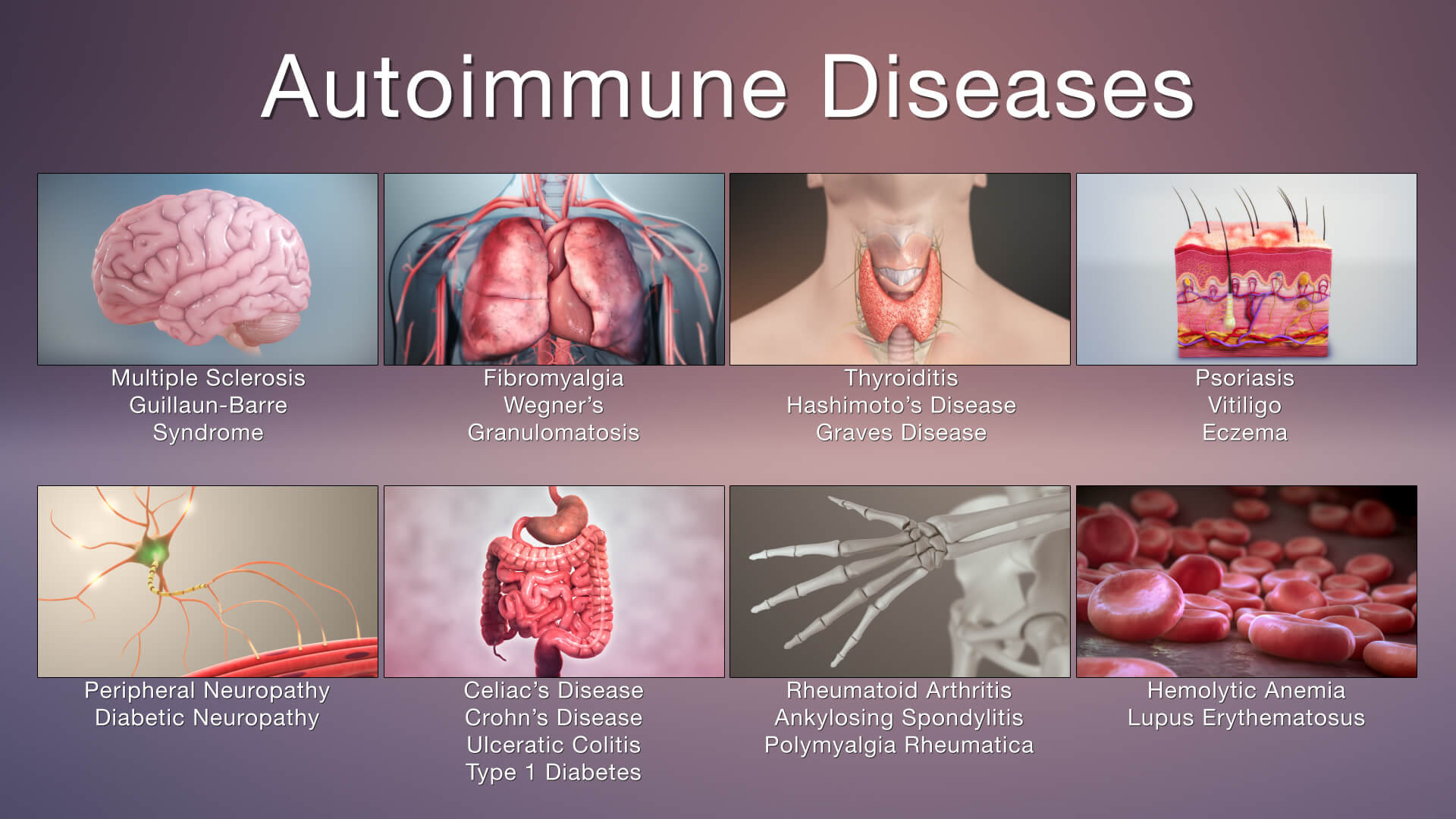 2 Types Of Autoimmune Diseases Systemic & OrganSpecific Simple