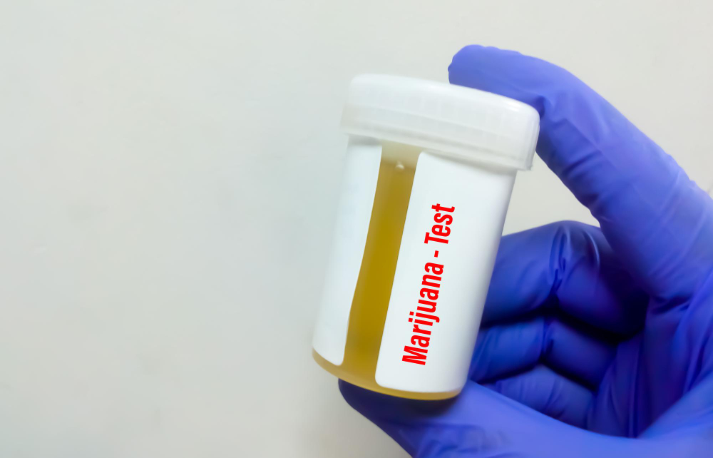 Urine Drug Test Detection Times Australia What You Need to Know