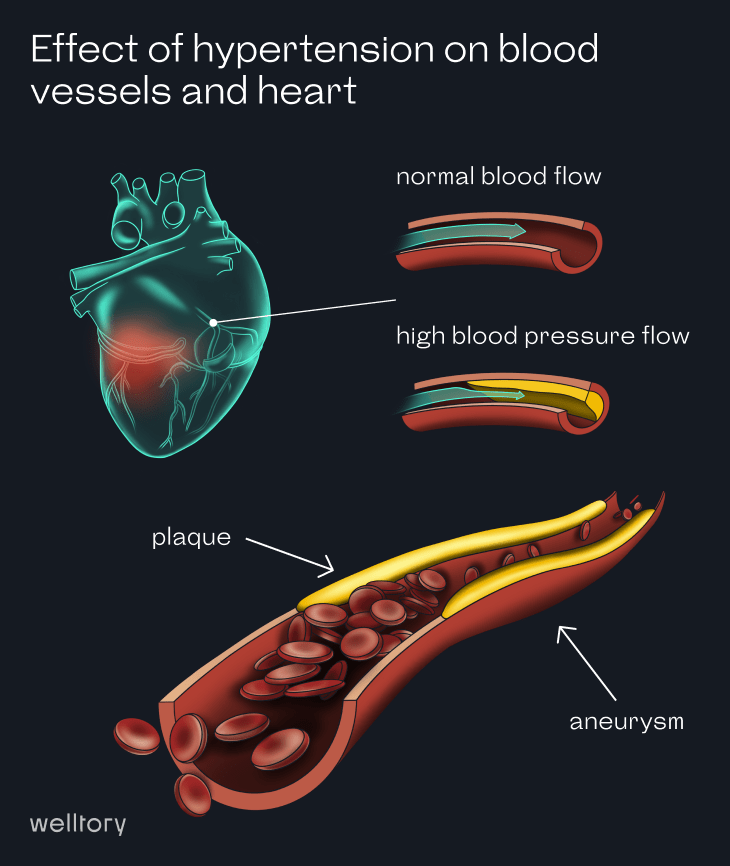 Blood pressure and how to analyze it with Welltory