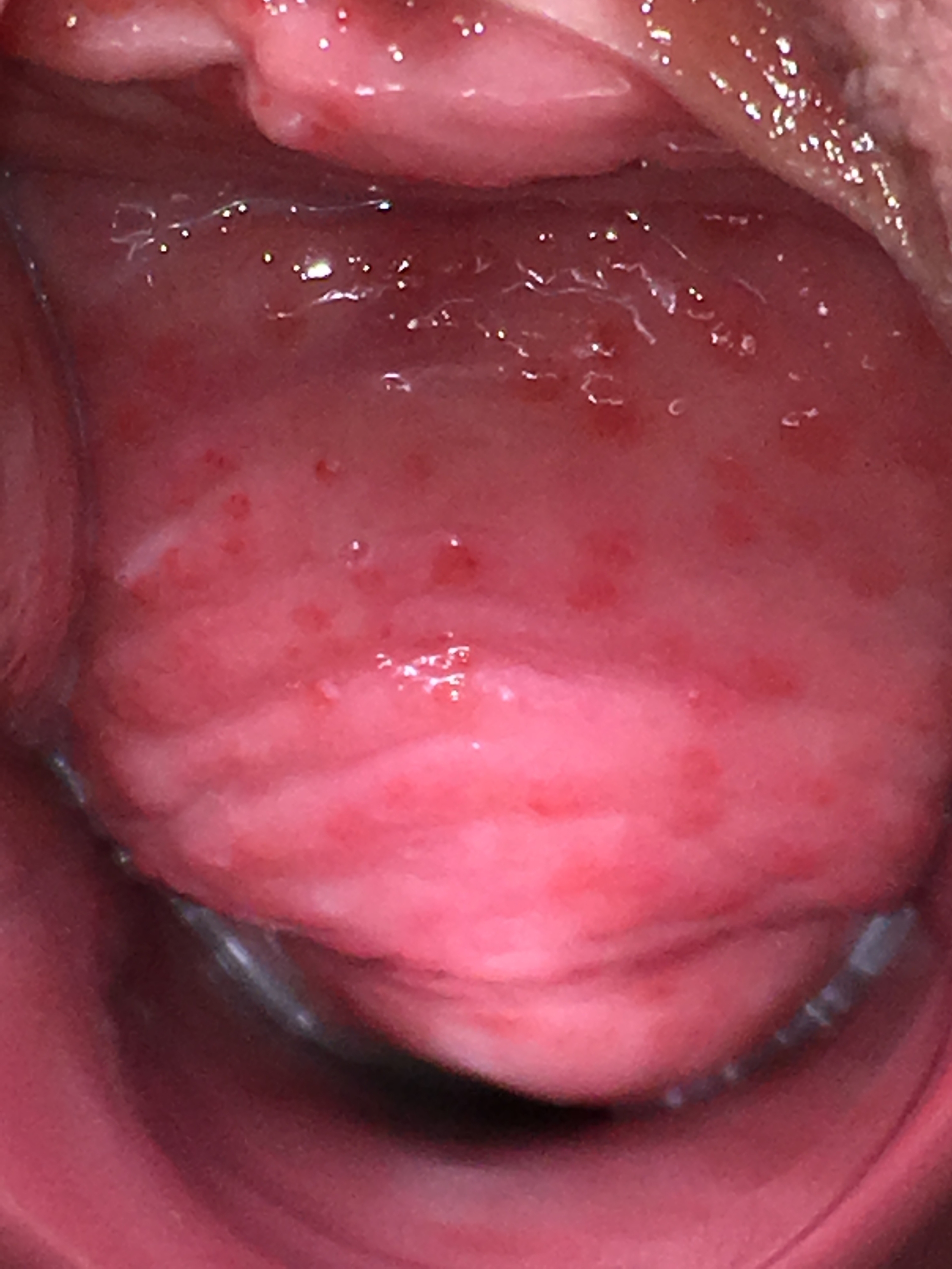 Lichen Sclerosus Und Lichen Planus Der Vulva | Prof. Dr. Med. Werner Mendling
