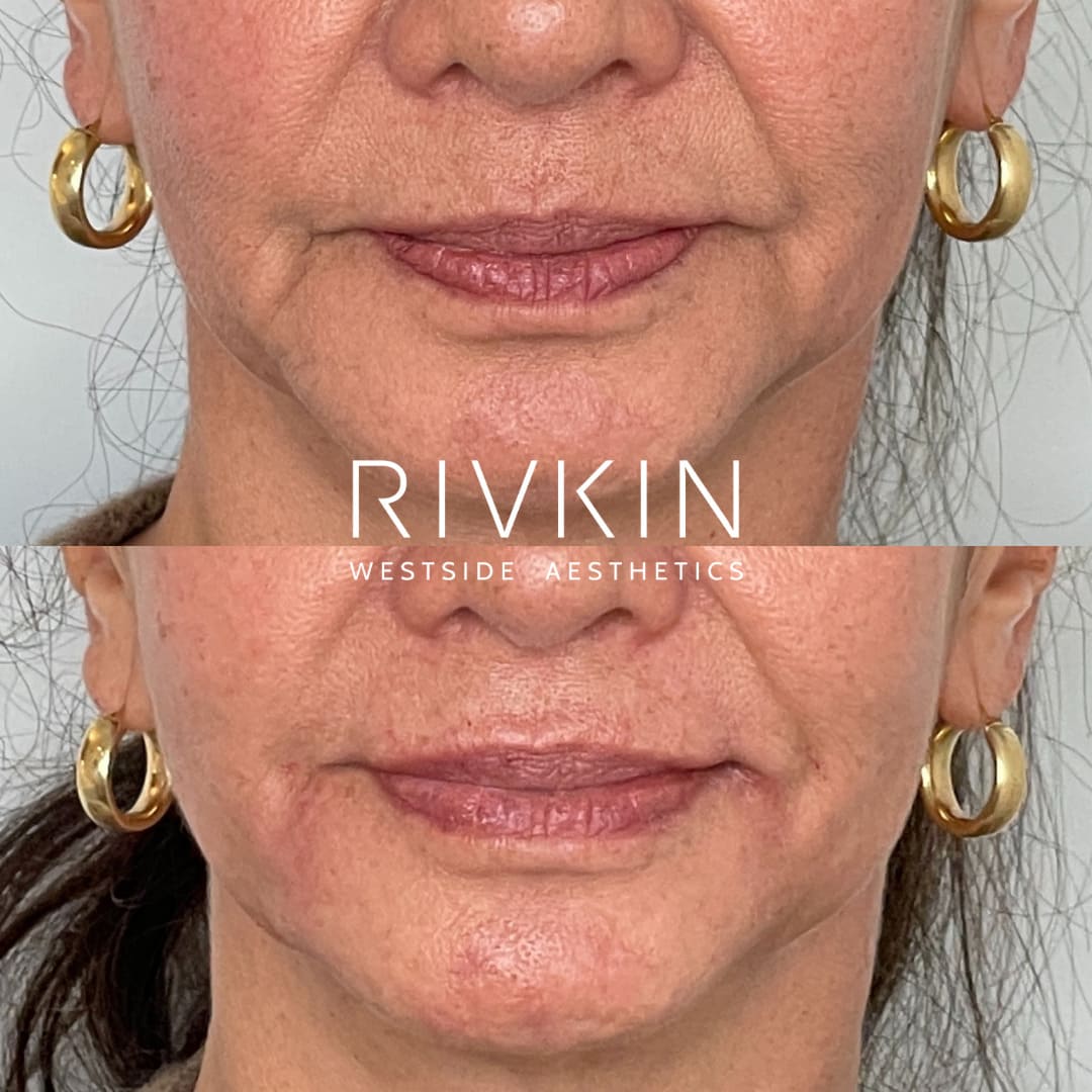 Lines RIVKIN Aesthetics