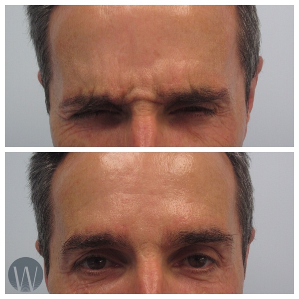 Face Case 2885 West Institute Chevy Chase Dermatology