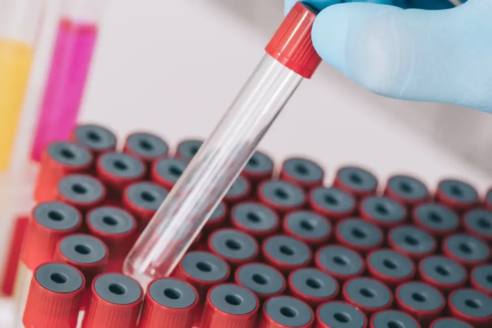 Storage Guidelines for Biological Specimens Duration and Conditions