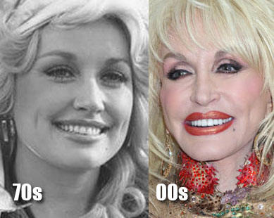 Dolly Parton