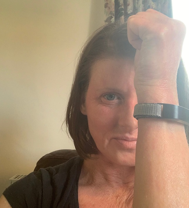 Soft FitBit strap for eczema What Allergy Blog