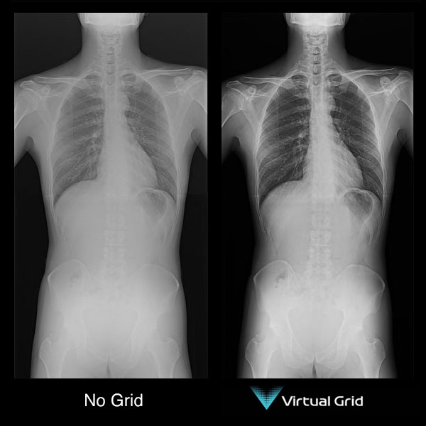 Fujifilm Virtual Grid White Mountain Imaging